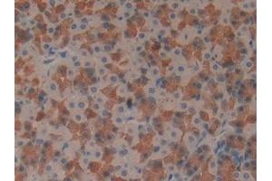 Detection of IFNg in Rat Stomach Tissue using Monoclonal Antibody to Interferon Gamma (IFNg)