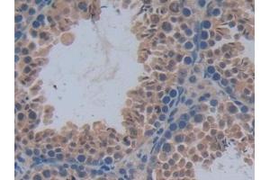 Detection of PFKP in Mouse Testis Tissue using Polyclonal Antibody to Phosphofructokinase, Platelet (PFKP)