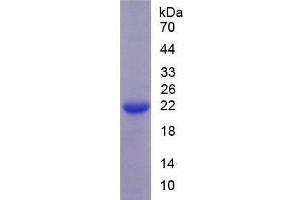 SDS-PAGE of Protein Standard from the Kit (Highly purified E. (SLC12A3 Kit ELISA)
