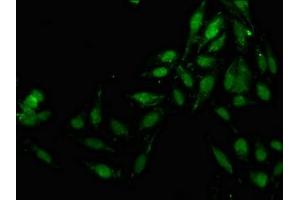Immunofluorescence staining of Hela cells with ABIN7157162 at 1:133, counter-stained with DAPI.