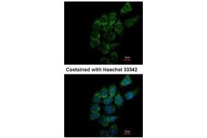 ICC/IF Image Immunofluorescence analysis of methanol-fixed Hep3B, using SIAT4A, antibody at 1:500 dilution. (ST3GAL1 anticorps)