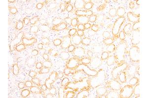 ABIN185030 (3. (FOXD1 anticorps  (C-Term))