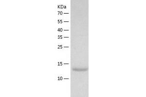 Western Blotting (WB) image for Cytidine Deaminase (CDA) (AA 1-146) protein (His tag) (ABIN7122565) (CDA Protein (AA 1-146) (His tag))