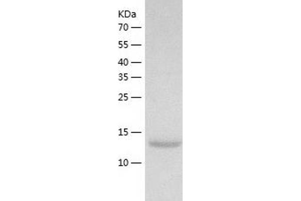 CDA Protein (AA 1-146) (His tag)