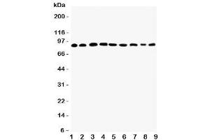 Western blot testing of Plakophilin 2 antibody and Lane 1:  rat heart (Plakophilin 2 anticorps  (C-Term))