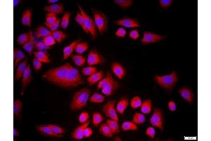 MCF-7 cells were stained with CDKN1B Polyclonal Antibody, Unconjugated at 1:500 in PBS and incubated for two hours at 37°C followed by Goat Anti-Rabbit IgG (H+L) Cy3 conjugated secondary antibody. (CDKN1B anticorps  (AA 150-198))