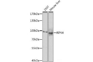Western blot analysis of extracts of various cell lines using RIPK4 Polyclonal Antibody at dilution of 1:1000. (RIPK4 anticorps)