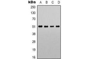 Western blot analysis of Alpha-1A Adrenergic Receptor expression in LOVO (A), Jurkat (B), NIH3T3 (C), PC12 (D) whole cell lysates. (alpha 1 Adrenergic Receptor anticorps  (C-Term))