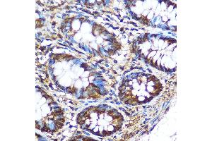Immunohistochemistry of paraffin-embedded Human colon using PKM2 Rabbit pAb (ABIN6128296, ABIN6145714, ABIN6145715 and ABIN6218076) at dilution of 1:100 (40x lens). (PKM anticorps  (AA 11-221))