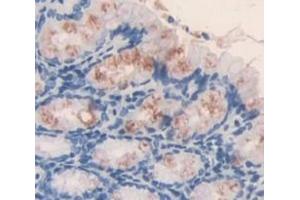 Used in DAB staining on fromalin fixed paraffin- embedded Kidney tissue (ICK anticorps  (AA 1-284))
