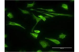 Immunofluorescence of monoclonal antibody to STIP1 on HeLa cell.