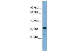 Image no. 1 for anti-Dehydrogenase/reductase (SDR Family) Member 9 (DHRS9) (AA 215-264) antibody (ABIN6741830) (DHRS9 anticorps  (AA 215-264))