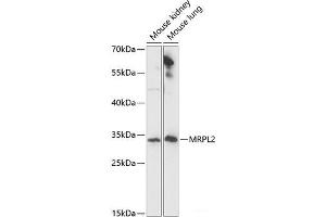 Western blot analysis of extracts of various cell lines using MRPL2 Polyclonal Antibody at dilution of 1:1000. (MRPL2 anticorps)