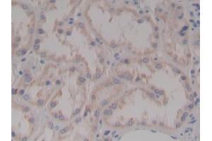 Detection of NPHN in Human Kidney Tissue using Polyclonal Antibody to Nephrin (NPHN)