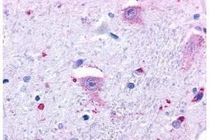Anti-GPR37 antibody  ABIN1048809 IHC staining of human brain, neurons and glia. (GPR37 anticorps  (N-Term))