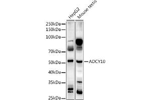 Western blot analysis of extracts of various cell lines, using  antibody (ABIN7265465) at 1:1000 dilution. (ADCY10 anticorps)