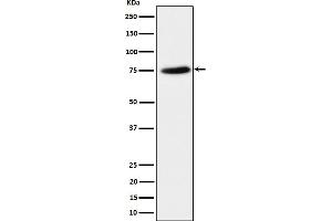 Western blot analysis of PPM1G expression in HeLa cell lysate.