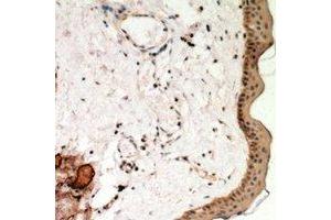 Immunohistochemical analysis of Desmoglein 1 staining in human skin formalin fixed paraffin embedded tissue section.