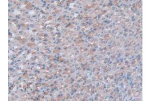 IHC-P analysis of Rat Stomach Tissue, with DAB staining. (Interferon gamma anticorps  (AA 23-156))