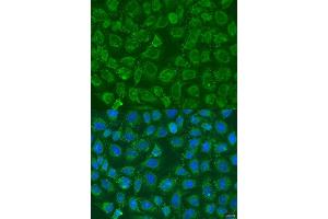 Immunofluorescence analysis of U2OS cells using PIP5K1B antibody (ABIN6130645, ABIN6145684, ABIN6145686 and ABIN6223693) at dilution of 1:100.