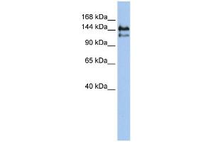 WB Suggested Anti-SUPT5H Antibody Titration:  0. (SUPT5H anticorps  (Middle Region))