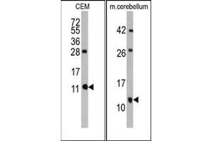 Image no. 1 for anti-FK506 Binding Protein 1B, 12.6 KDa (FKBP1B) (AA 1-30), (N-Term) antibody (ABIN360231)