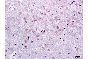Formalin-fixed and paraffin embedded rat brain tissue labeled with Anti-KDM5B/PLU1/Jarid1B Polyclonal Antibody, Unconjugated (ABIN762986) at 1:200 followed by conjugation to the secondary antibody and DAB staining (KDM5B anticorps  (AA 65-165))
