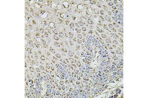 Immunohistochemistry of paraffin-embedded human esophagus using TMC1 antibody. (TMC1 anticorps)