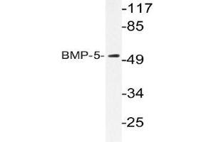 Western blot analysis of BMP-5 Antibody in extracts from HUVEC cells. (BMP5 anticorps)