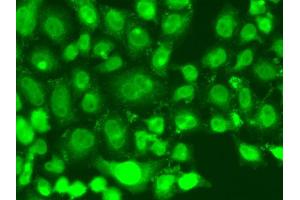 Immunofluorescence analysis of A549 cell using TSEN2 antibody.