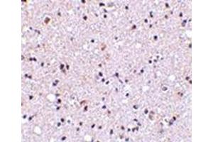 Immunohistochemistry of TMP21 in human brain tissue with this product at 5 μg/ml. (TMED10 anticorps  (Center))