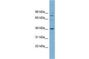 Image no. 1 for anti-Cancer Susceptibility Candidate 3 (CASC3) (N-Term) antibody (ABIN6742086) (CASC3 anticorps  (N-Term))