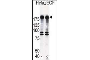 Western blot analysis of EGFR (arrow) in Hela cell lysates, either induced (Lane 1) or noninduced with EGF (Lane 2). (EGFR anticorps  (AA 1048-1077))