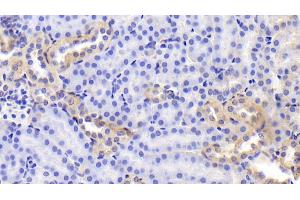 Detection of FN in Mouse Kidney Tissue using Polyclonal Antibody to Fibronectin (FN) (Fibronectin anticorps  (AA 2117-2236))