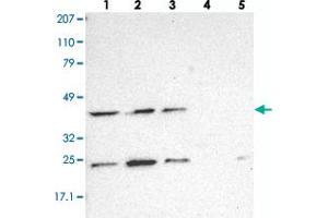 Western blot analysis of Lane 1: RT-4, Lane 2: EFO-21, Lane 3: A-431, Lane 4: Liver, Lane 5: Tonsil with DRG1 polyclonal antibody . (DRG1 anticorps)