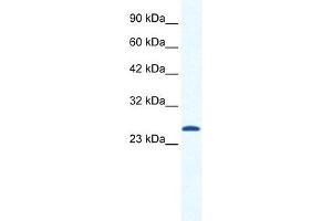 CACNG6 antibody used at 1. (CACNG6 anticorps  (N-Term))