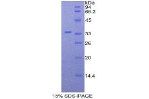 SDS-PAGE (SDS) image for Myosin ID (MYO1D) (AA 581-847) protein (His tag) (ABIN1878327)