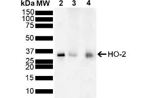 Western blot analysis of Mouse, Rat Brain showing detection of ~36 kDa HO-2 protein using Rabbit Anti-HO-2 Polyclonal Antibody (ABIN5696131). (HMOX2 anticorps  (FITC))
