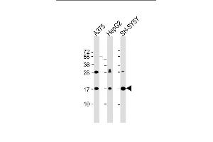 All lanes : Anti-SRP14 Antibody (Center) at 1:2000 dilution Lane 1:  whole cell lysate Lane 2: HepG2 whole cell lysate Lane 3: SH-SY5Y whole cell lysate Lysates/proteins at 20 μg per lane. (SRP14 anticorps  (AA 28-55))