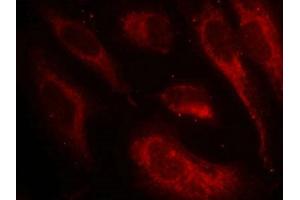 Immunofluorescence staining of methanol-fixed Hela cells using HSF1(Phospho-Ser307) Antibody.