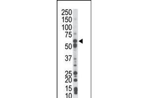 Antibody is used in Western blot to detect PCK1 in mouse liver tissue lysate. (PCK1 anticorps  (N-Term))