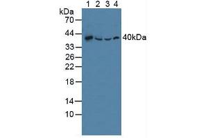 Figure. (SQSTM1 anticorps  (AA 136-400))