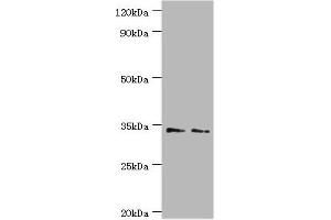Western blot All lanes: Killer cell immunoglobulin-like receptor 2DS4 antibody at 4 μg/mL Lane 1: K562 whole cell lysate Lane 2: Jurkat whole cell lysate Secondary Goat polyclonal to rabbit IgG at 1/10000 dilution Predicted band size: 34 kDa Observed band size: 34 kDa