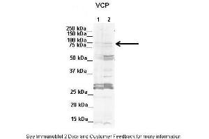 Lanes:  1. (VCP anticorps  (C-Term))