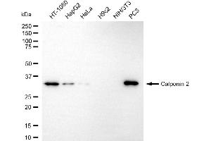Western blotting analysis using calponin 2 antibody (ABIN7797852). (CNN2 anticorps)