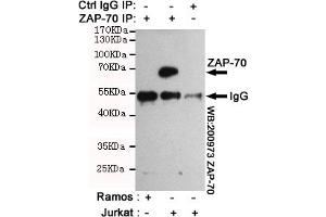 Immunoprecipitation analysis of Jurkat cell lysates (Z70 positive expression cell line)and Ramos cell lysates(Z70 negative expression cell line) using Z70 mouse mAb.