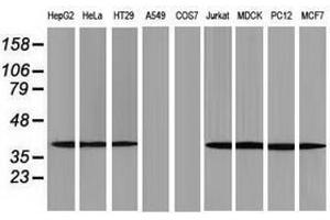 Image no. 8 for anti-Acetyl-CoA Acetyltransferase 2 (ACAT2) antibody (ABIN1496396)