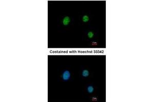 ICC/IF Image Immunofluorescence analysis of paraformaldehyde-fixed HeLa, using PAX9, antibody at 1:200 dilution. (PAX9 anticorps)