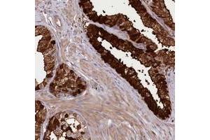 Immunohistochemical staining of human prostate with KIAA1731 polyclonal antibody  shows strong cytoplasmic and membranous positivity in glandular cells at 1:200-1:500 dilution. (KIAA1731 (KIAA1731) anticorps)