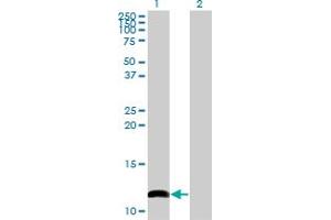 Western Blot analysis of COX6B1 expression in transfected 293T cell line by COX6B1 monoclonal antibody (M02), clone 2D3. (COX6B1 anticorps  (AA 1-86))